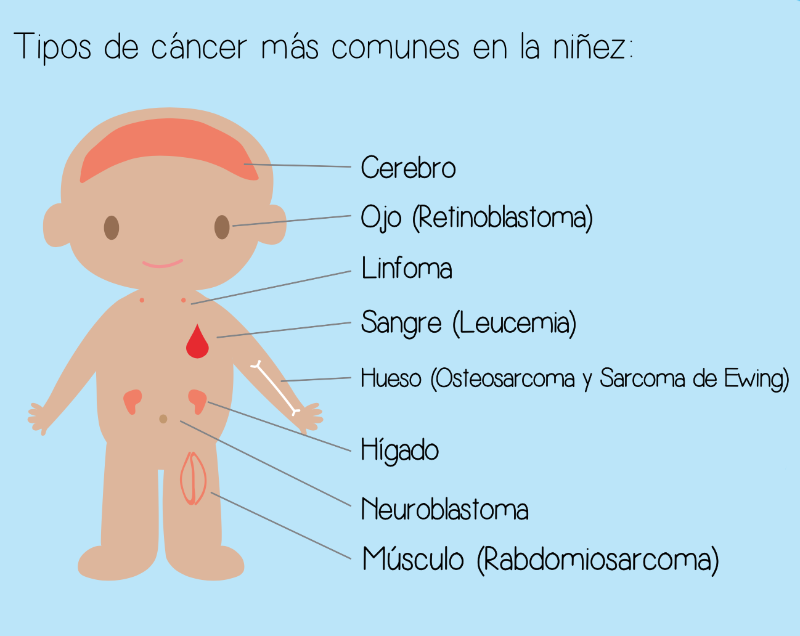 Tipos de cáncer en los niños